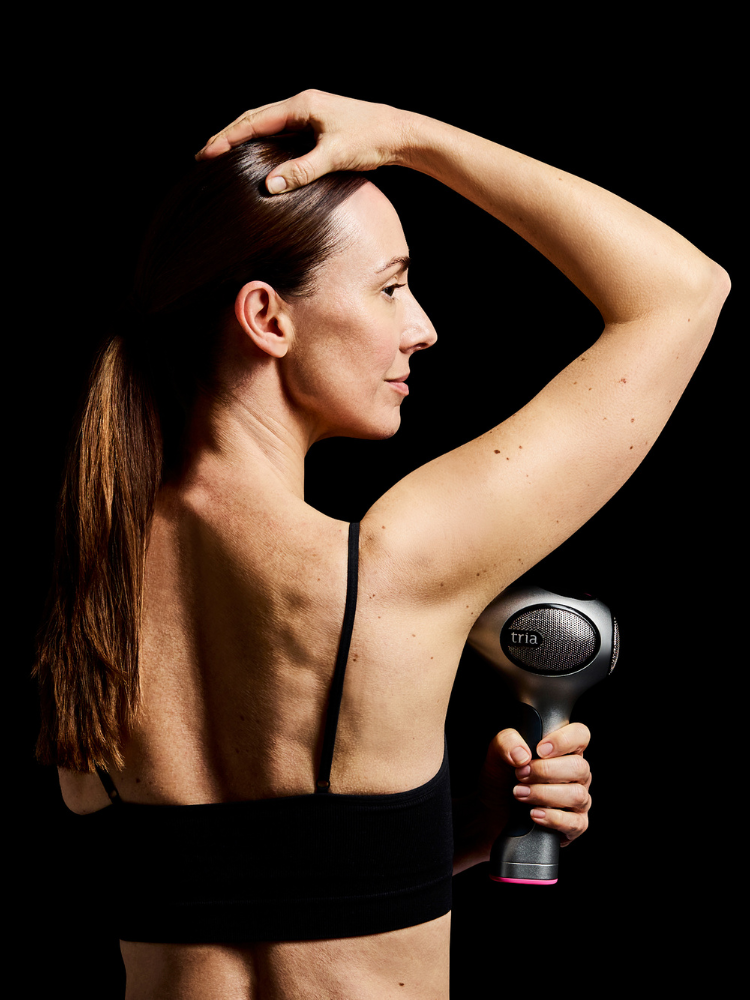 Tria 4X Laser zur Haarentfernung (2. Generation)